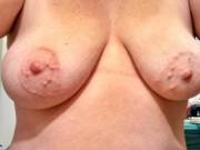 ZOIG - bumpy nipples porn collection by FarmBoy