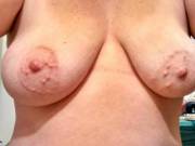 Big Bumpy Areolas Nipples - ZOIG - bumpy nipples porn collection by FarmBoy