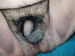 My Penis Hairy My Penis Hairy